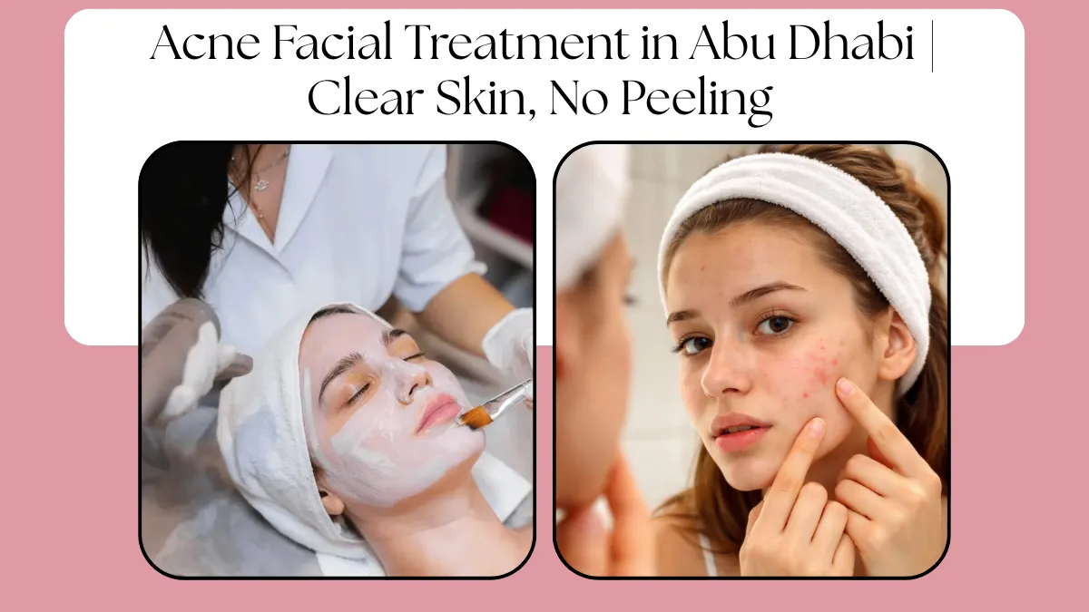 Acne Facial Treatment in Abu Dhabi